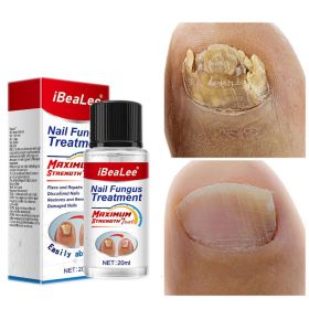 Thickening Of Special Bacteriostatic Liquid For Onychomycosis (Option: 20ml)